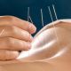 anatomical acupuncture physiotherapy ottawa byward market